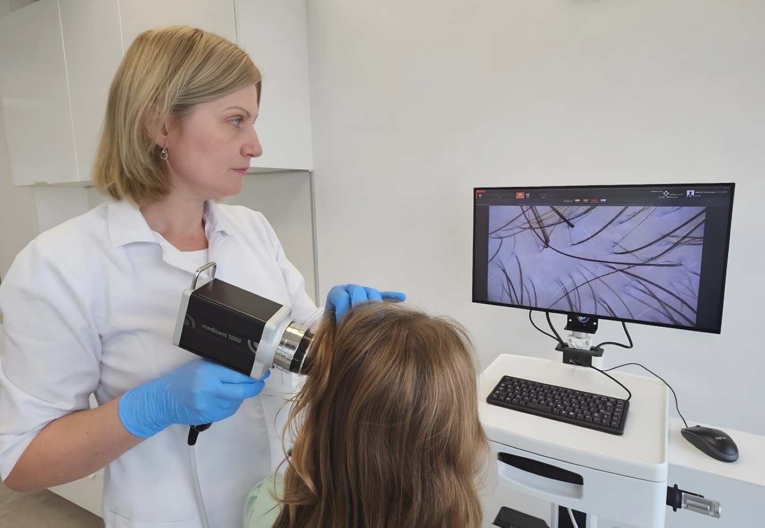 Trichoskopia-Vumed Vumed-Trichoskopia